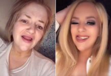 It’s hard to imagine that this blogger, who previously had missing teeth, has suddenly transformed into a princess in a miraculous way